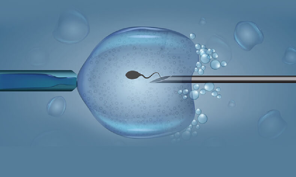 ivf doctor in siliguri