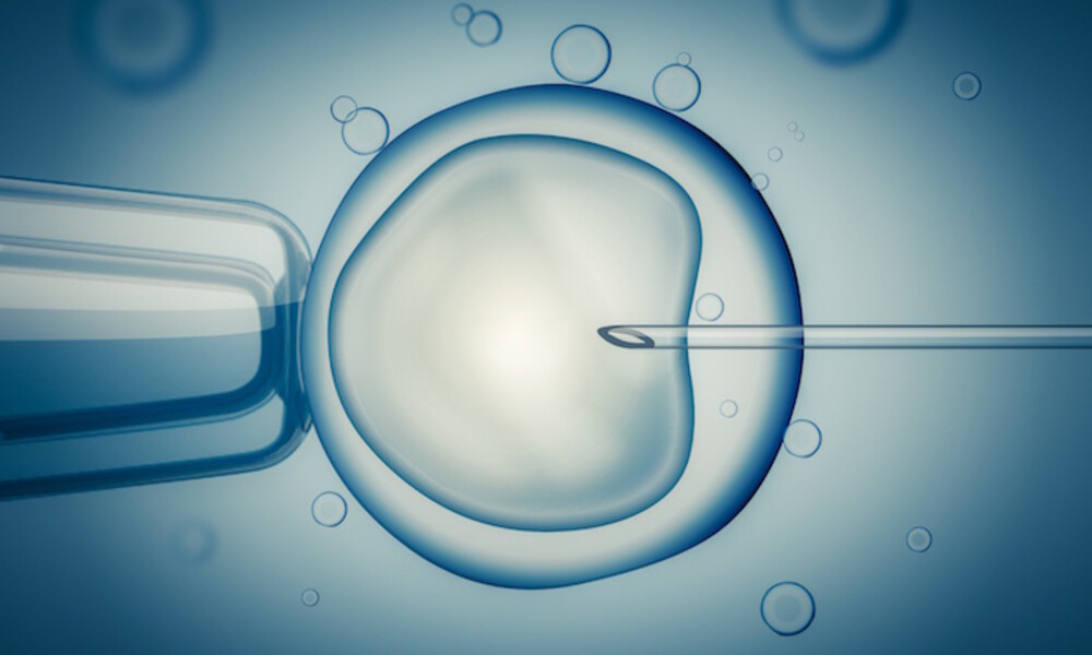 ivf doctor in siliguri